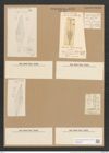 Stauroneis stodderi Greenl. (de-Toni-Nr.: Genus 6, Species 954) Zeichnungen Sammlung Grunow Nr. 1798 (NHMW-BOT-W0368706)